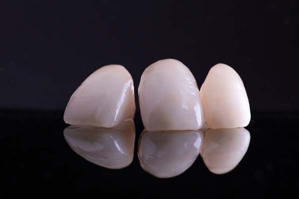 How A Cosmetic Dentist Can Restore Teeth With A Dental Crown