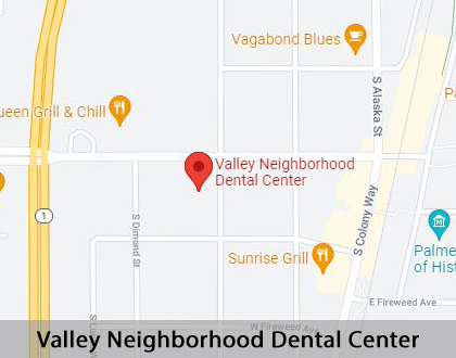 Map image for Partial Denture for One Missing Tooth in Palmer, AK